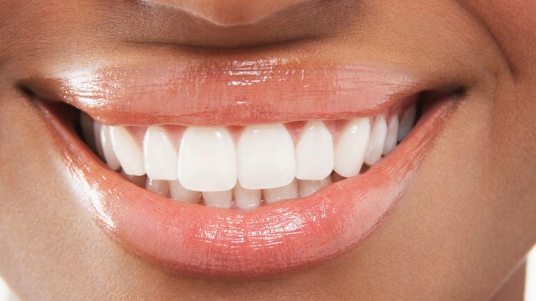 closeup-of-woman-smiling-with-perfect-white-teeth-by-mdbpixs-adobe-stock